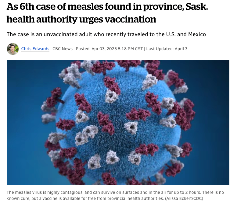 萨斯喀彻温省发现了第六例麻疹病例，该省卫生部门呼吁民众接种疫苗